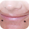 Snakebite Piercing